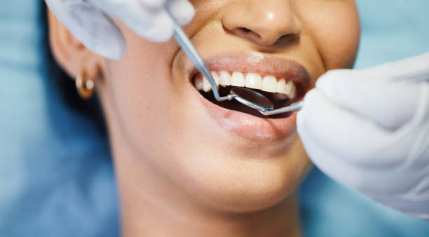 Best Emergency Wisdom Teeth Removal in Compo, CT