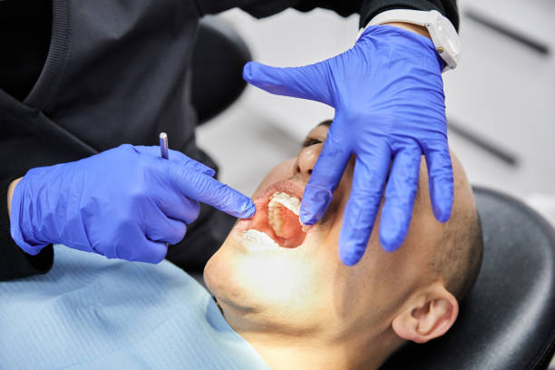 Best Emergency Tooth Extraction in Compo, CT